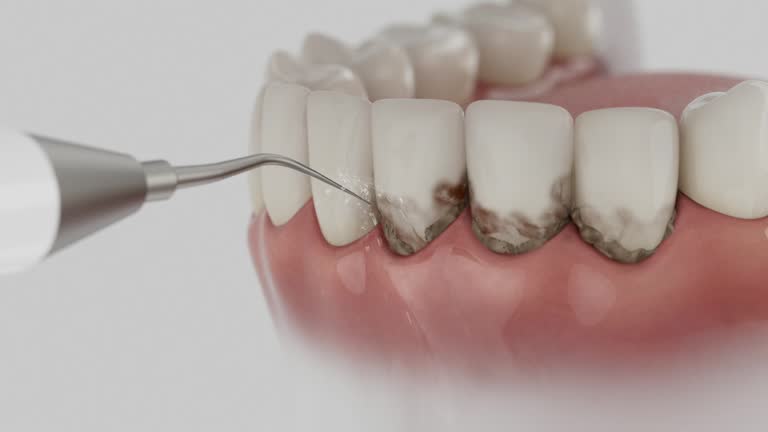 Reliable Dental Implants contractor in Brookland, AR by Smile Center Dentistry